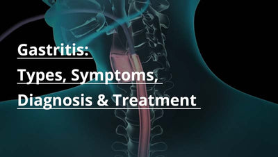 What Is A Gastritis - Symptoms, Types, Diagnosis, Diet Plan And Supplements