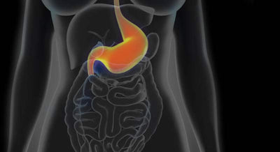 The Right Diet For Gastritis - Foods To Eat and Avoid With Gastritis