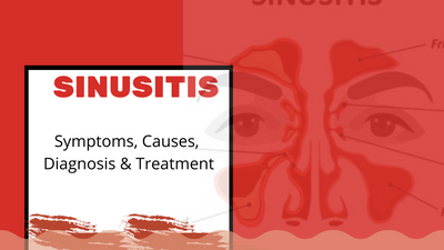 Sinusitis: Symptoms, Causes, Diagnosis & Treatment
